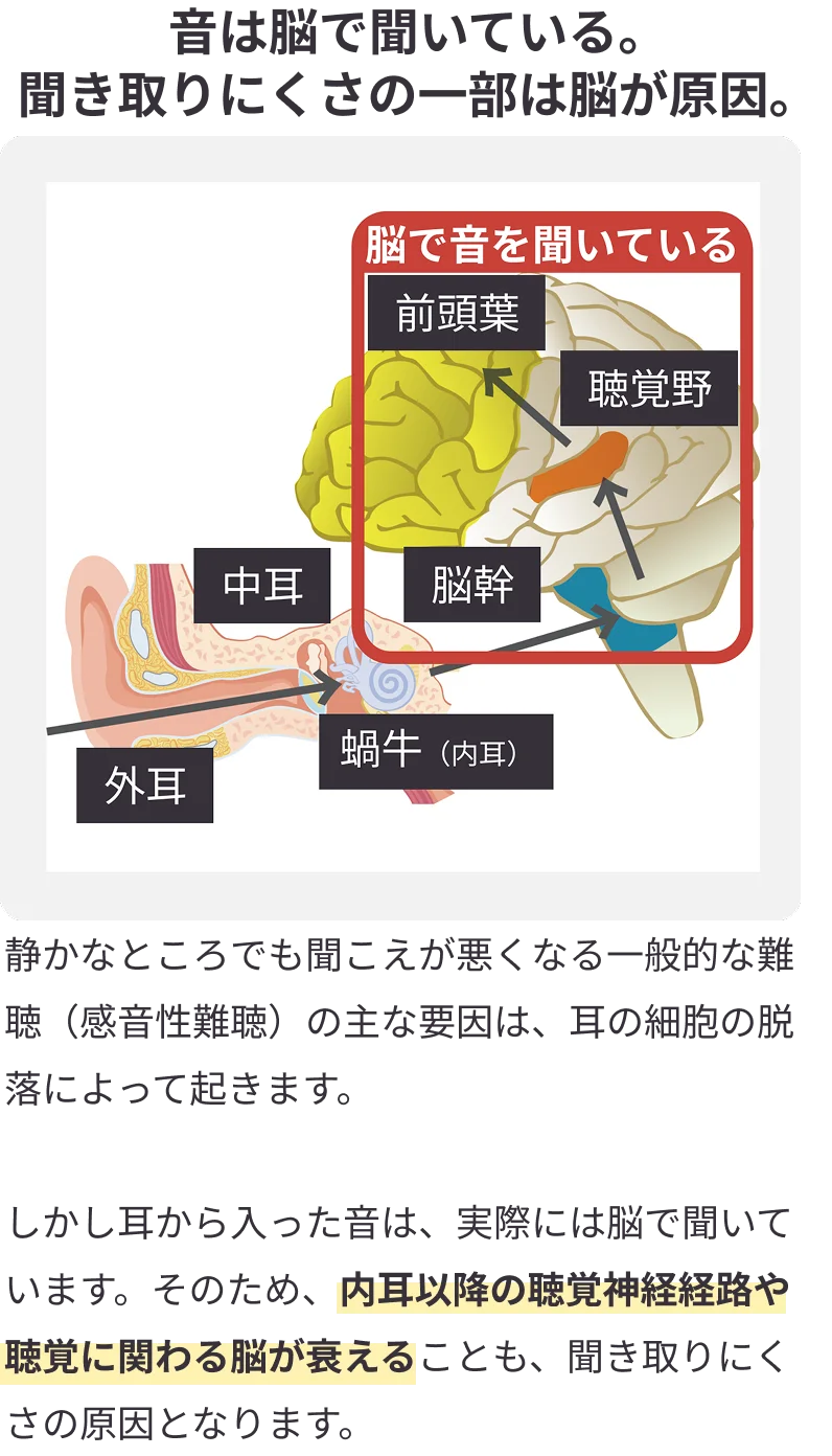 brain-is-hearing